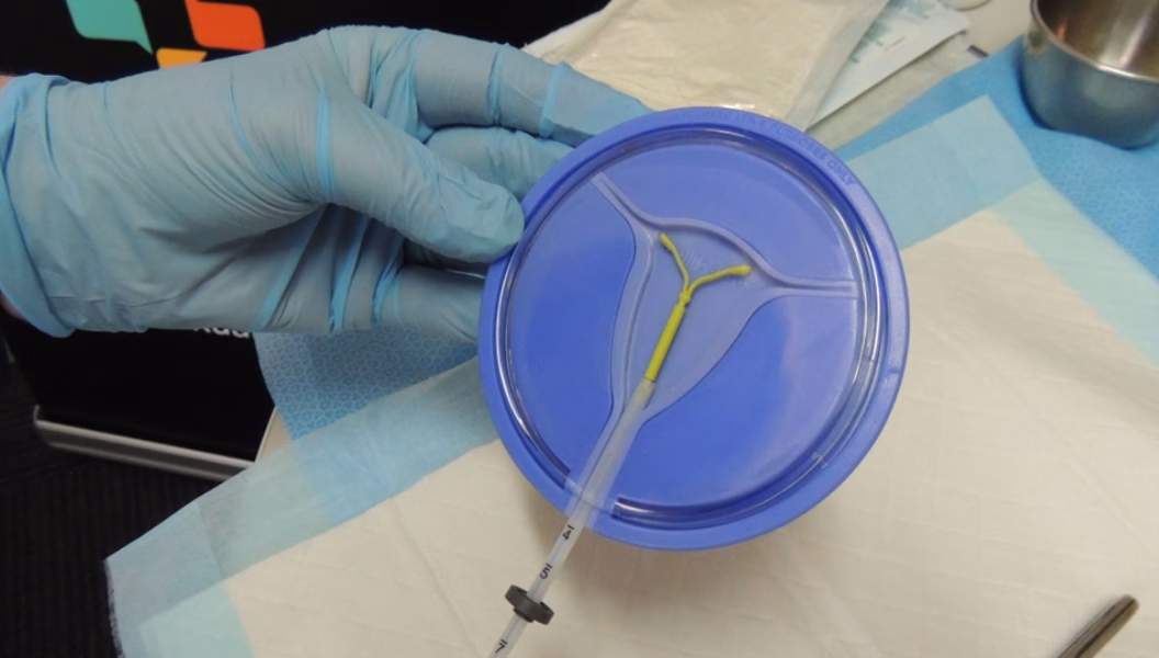 IUD Insertion Training